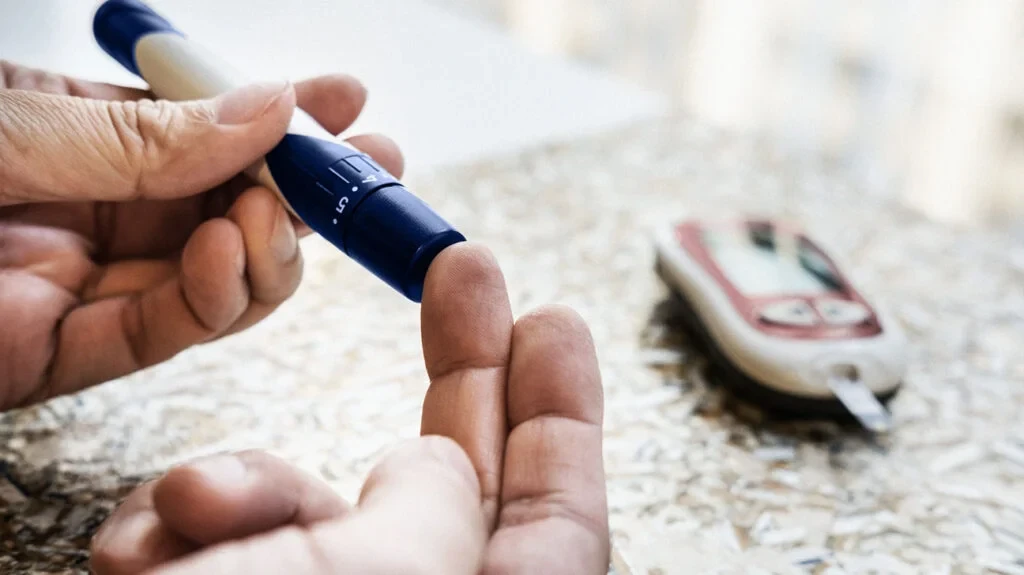 Vital sign (BP,sugar,pulse) ₹250